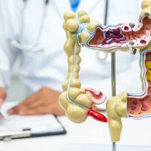 Sete alimentos que podem prejudicar a saúde do seu intestino; entenda