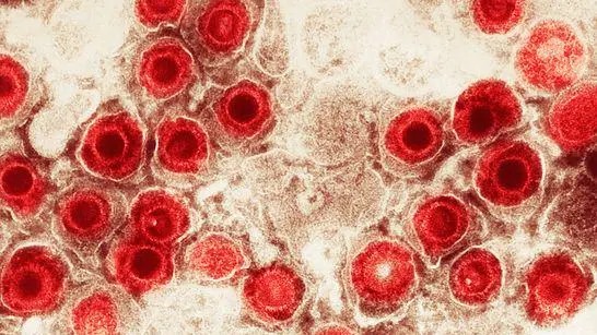 Vírus comuns podem aumentar o risco de Alzheimer?