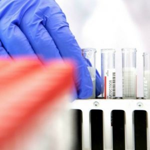 Científicos chinos presentan nuevo test anticovid ultrarrápido