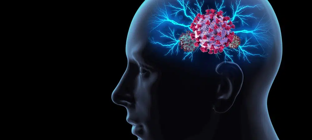 Resposta imune à Covid-19 pode causar danos ao cérebro