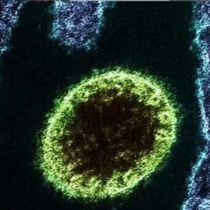 Decenas de personas infectadas en China con nuevo virus Langya: lo que se sabe hasta ahora