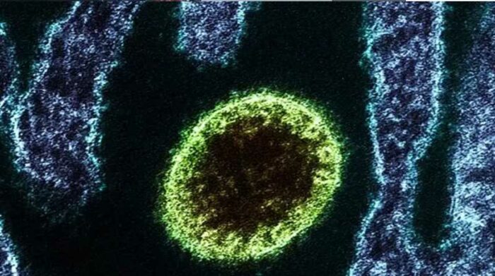 Decenas de personas infectadas en China con nuevo virus Langya: lo que se sabe hasta ahora