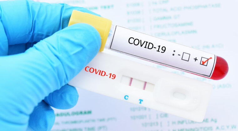 Casos de COVID en aumento: se proyecta ola de contagios entre diciembre y enero
