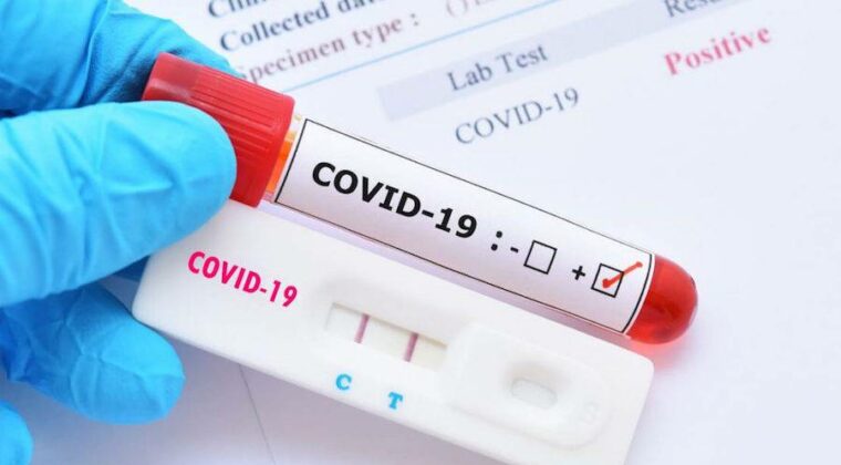 Más de 1.300 nuevos casos positivos de COVID-19 en una semana