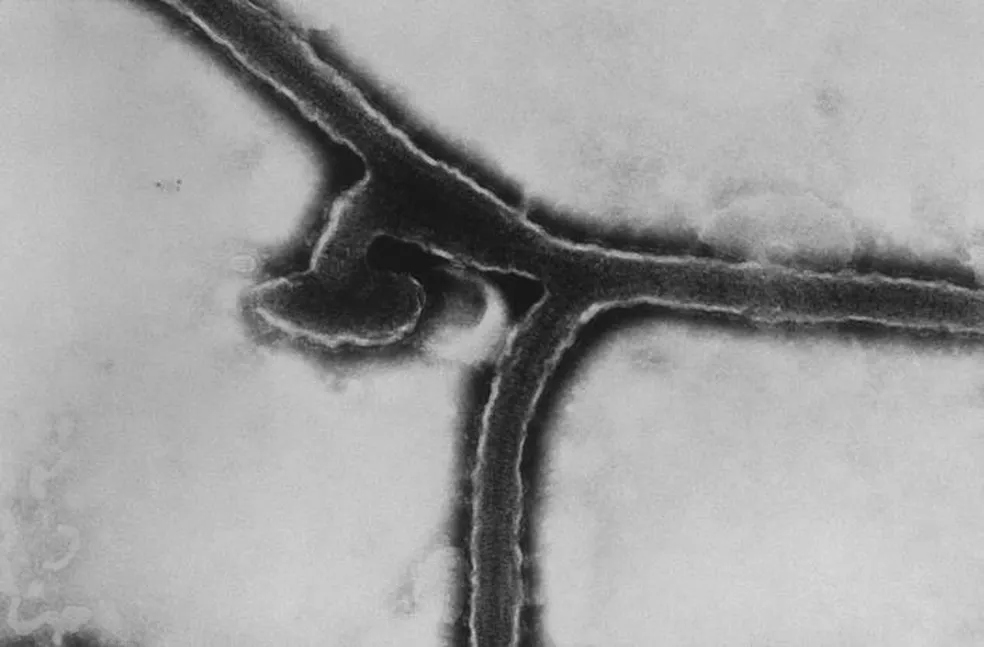 Marburg: entenda o que é o vírus primo do ebola e com alta taxa de mortalidade