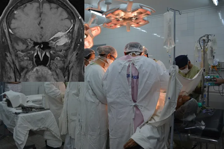 Médicos de IPS extraen un tumor de más de diez kilos