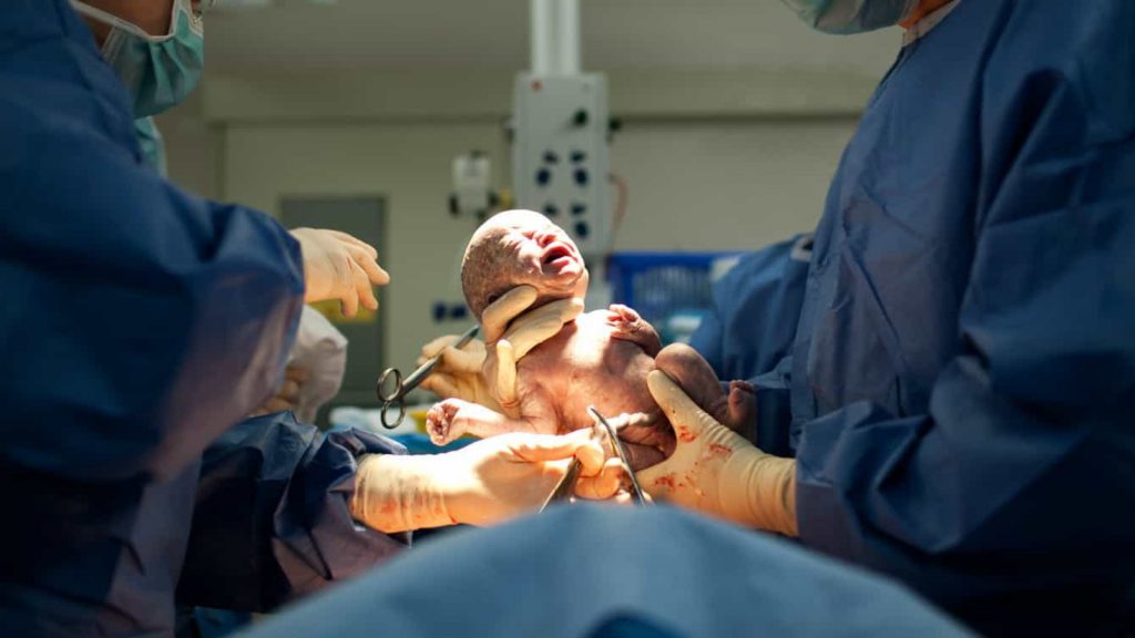 Mulher em morte cerebral há mais de dois meses dá à luz bebê saudável