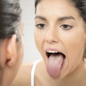 Câncer de boca: Sinais que você não pode ignorar